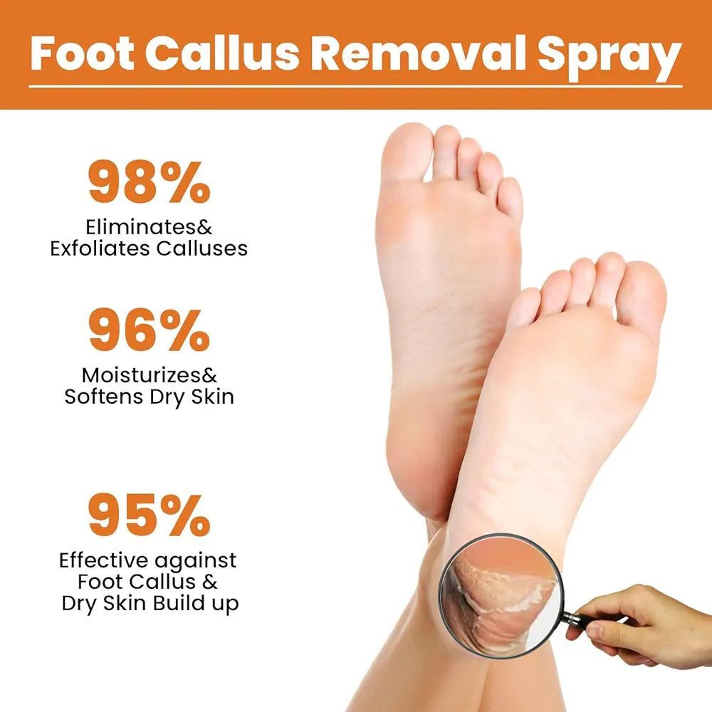 Curas SPRAY REMOVEDOR DE CALLOS